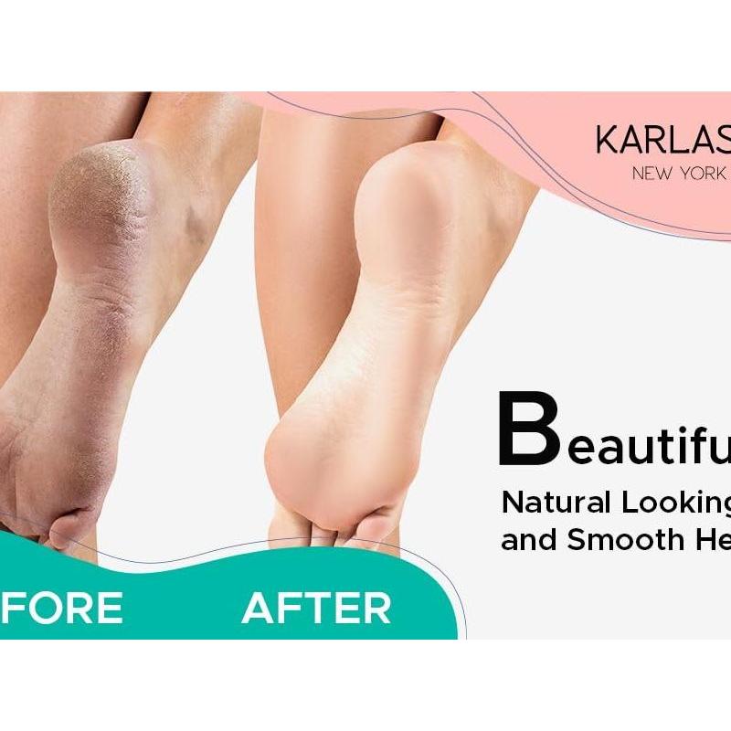 targets hard skin on heels, balls of feet, and tough calloused areas